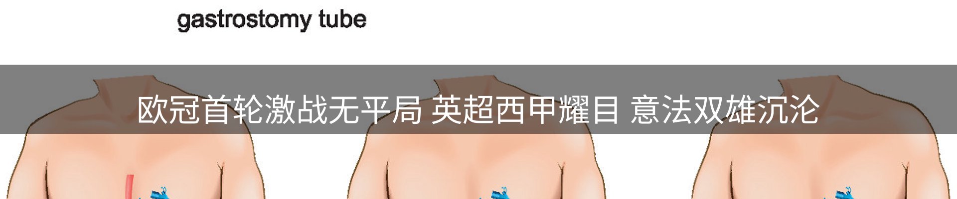 新闻汇聚